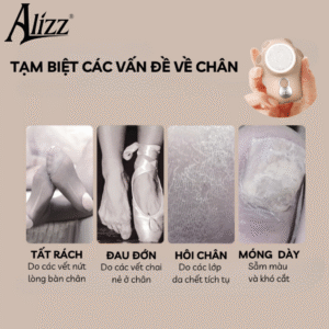 1035 may cha got chan hinh chan meo alizz