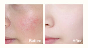 0354 may massage nang co lam cang da mat hih 1